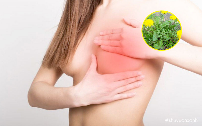 Bồ công anh có tác dụng chữa tắc tia sữa